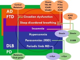 Predicting neurodegeneration from sleep related biofluid changes