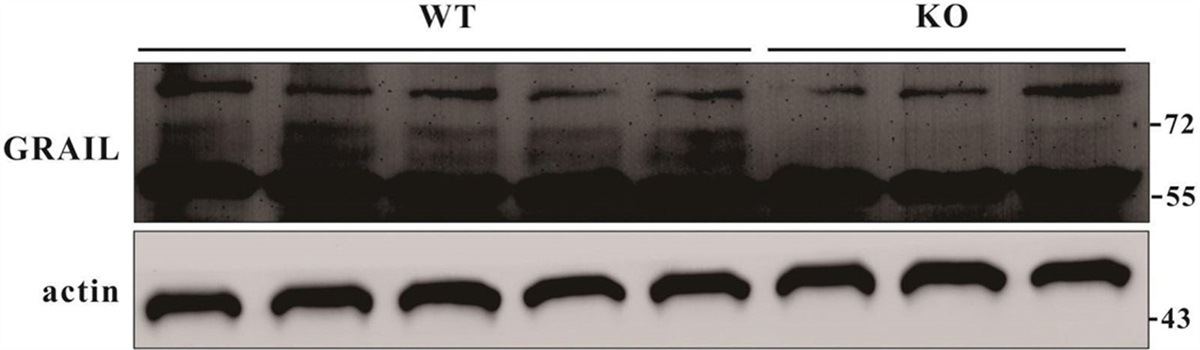 GRAIL gene knockout mice protect against aging-related and noise-induced hearing loss