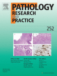 Dysregulation of DNA epigenetic modulators during prostate carcinogenesis in an eastern Indian patient population: Prognostic implications