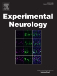 Bone marrow mesenchymal stem cells therapy regulates sphingolipid and glycerophospholipid metabolism to promote neurological recovery in stroke rats: A metabolomics analysis