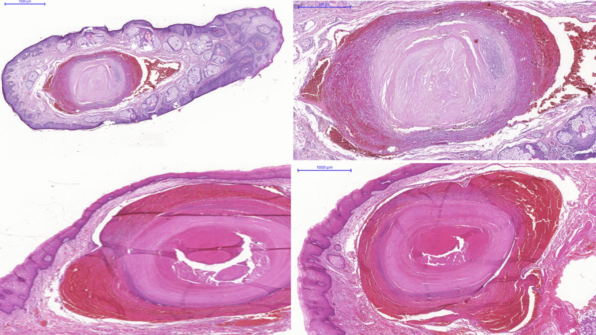 Cross-sectional study of sublingual varicosities: systemic exposures