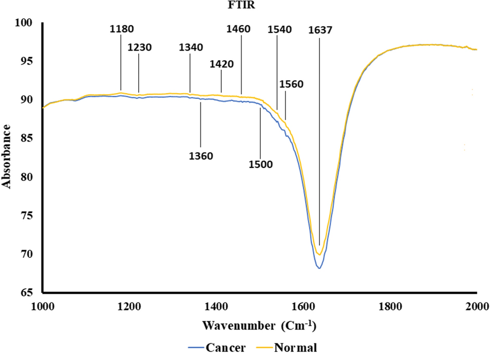 Saliva Based Diagnostic Prediction of Oral Squamous Cell Carcinoma using FTIR Spectroscopy