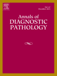 Interobserver agreement of pathologic classification and grading of tumoral intraductal pre-invasive neoplasms of the bile duct
