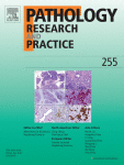 The molecular mechanisms of various long non-coding RNA (lncRNA) in human lung tumors: shedding light on the molecular mechanisms