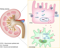 Oxalate regulates crystal-cell adhesion and macrophage metabolism via JPT2/PI3K/AKT signaling to promote the progression of kidney stones