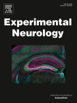 Cisplatin induces BDNF downregulation in middle-aged female rat model while BDNF enhancement attenuates cisplatin neurotoxicity