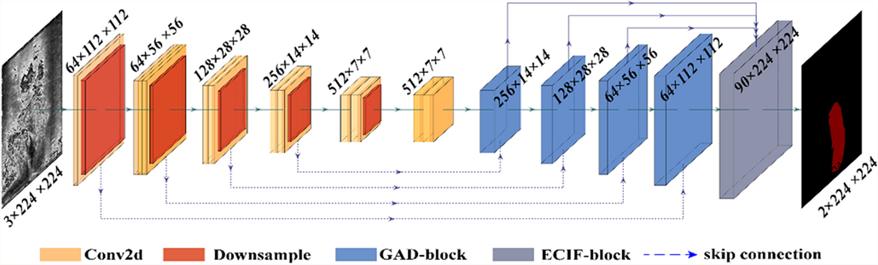 A Neural Network for Segmenting Tumours in Ultrasound Rectal Images