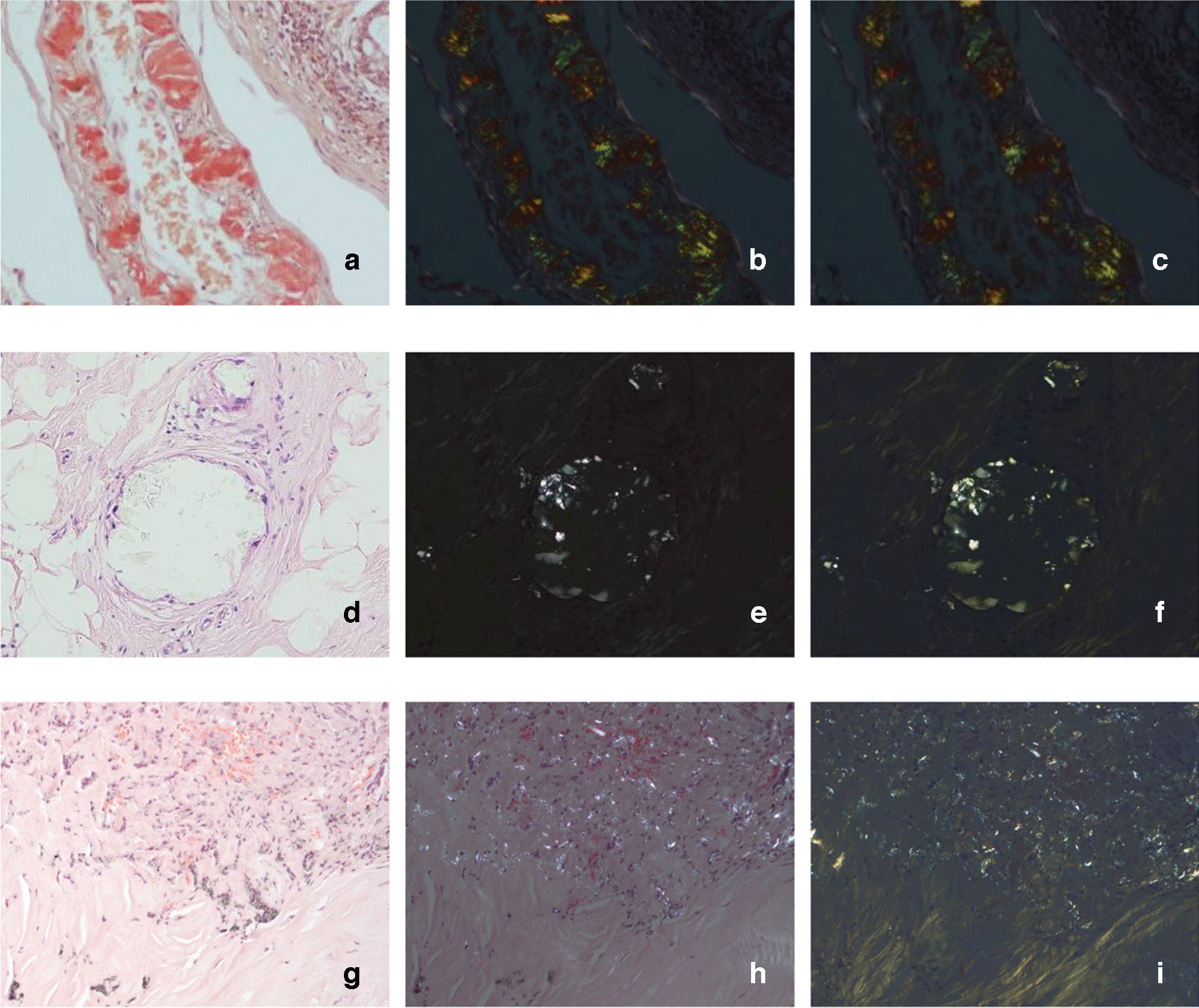 Polarised light scanner for digital pathology
