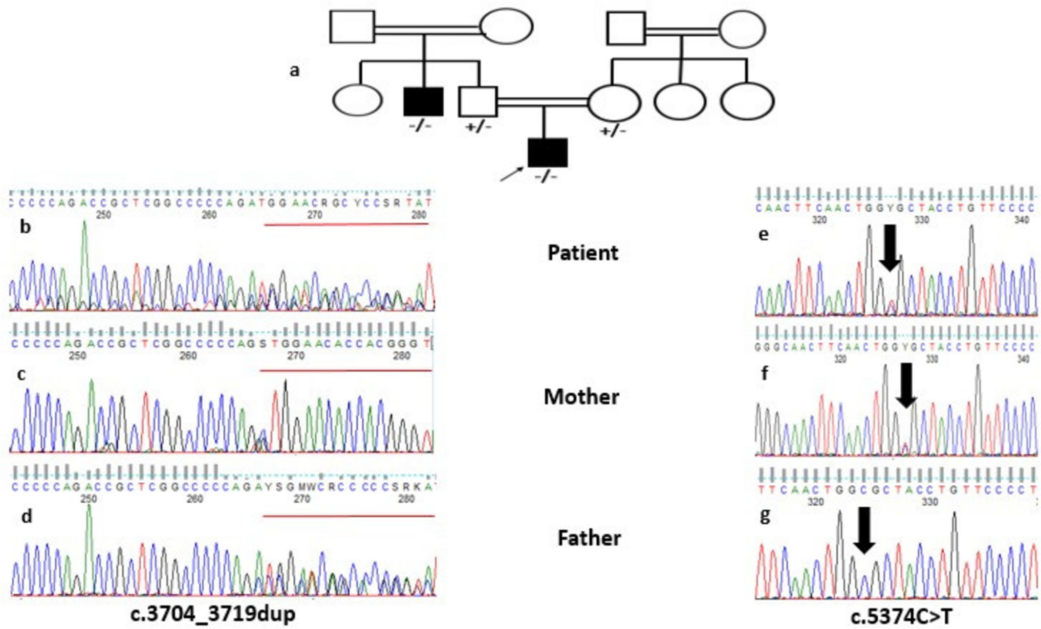 Molecular and Clinical Characterization of a Cohort of Autosomal Recessive Sensorineural Hearing Loss in Egyptian Patients
