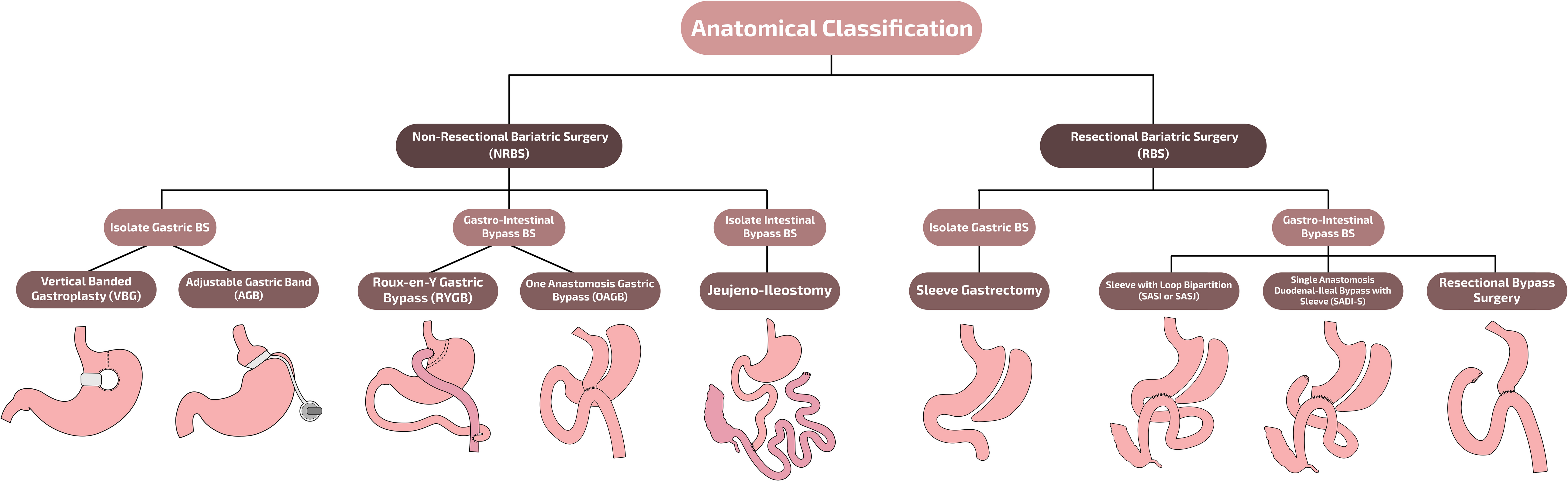 Advancements in Bariatric Surgery: A Novel Parametric Classification of Metabolic and Bariatric Procedures