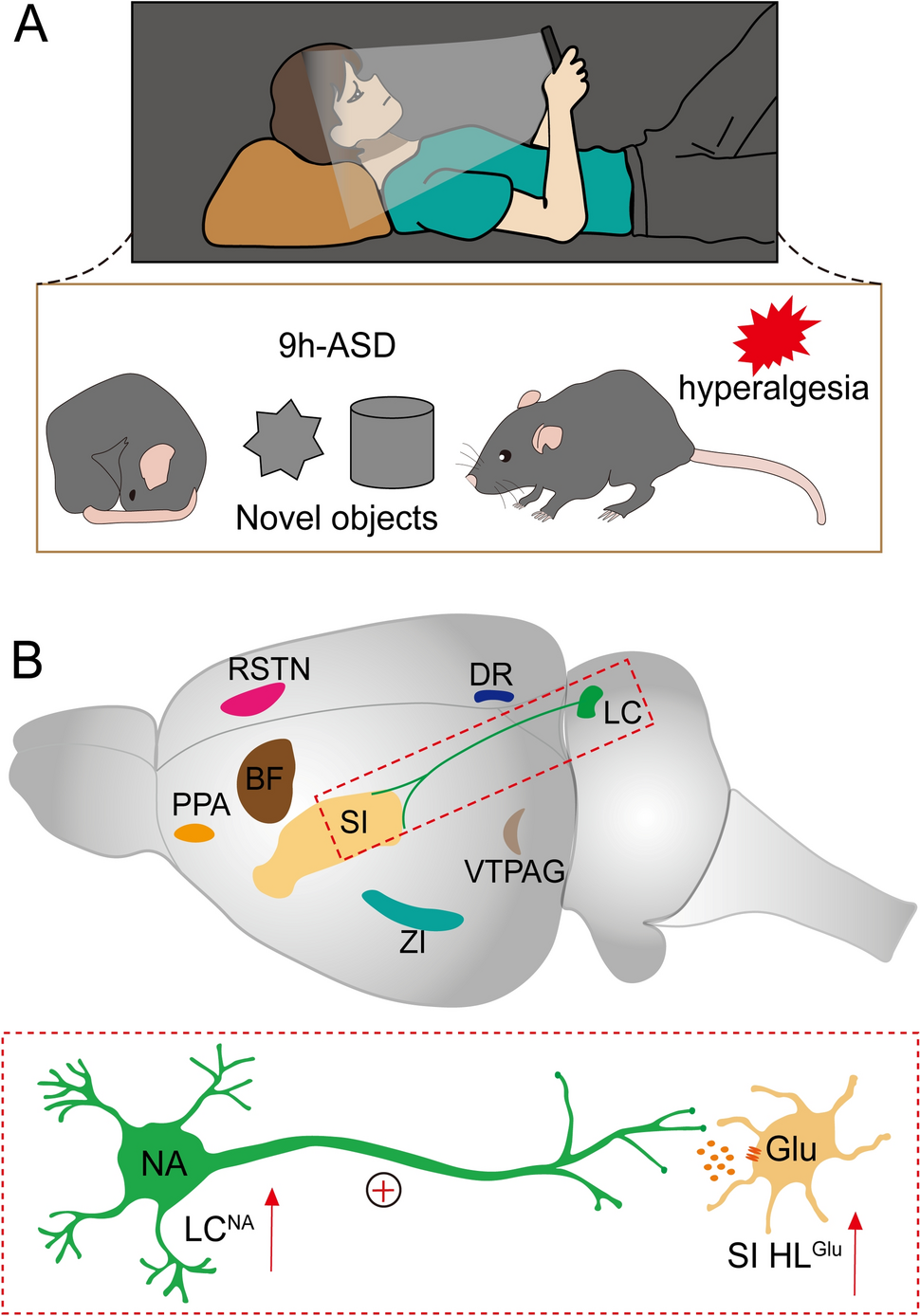 A New Pathway Mediating Pain Sensitization after Active Sleep Deprivation
