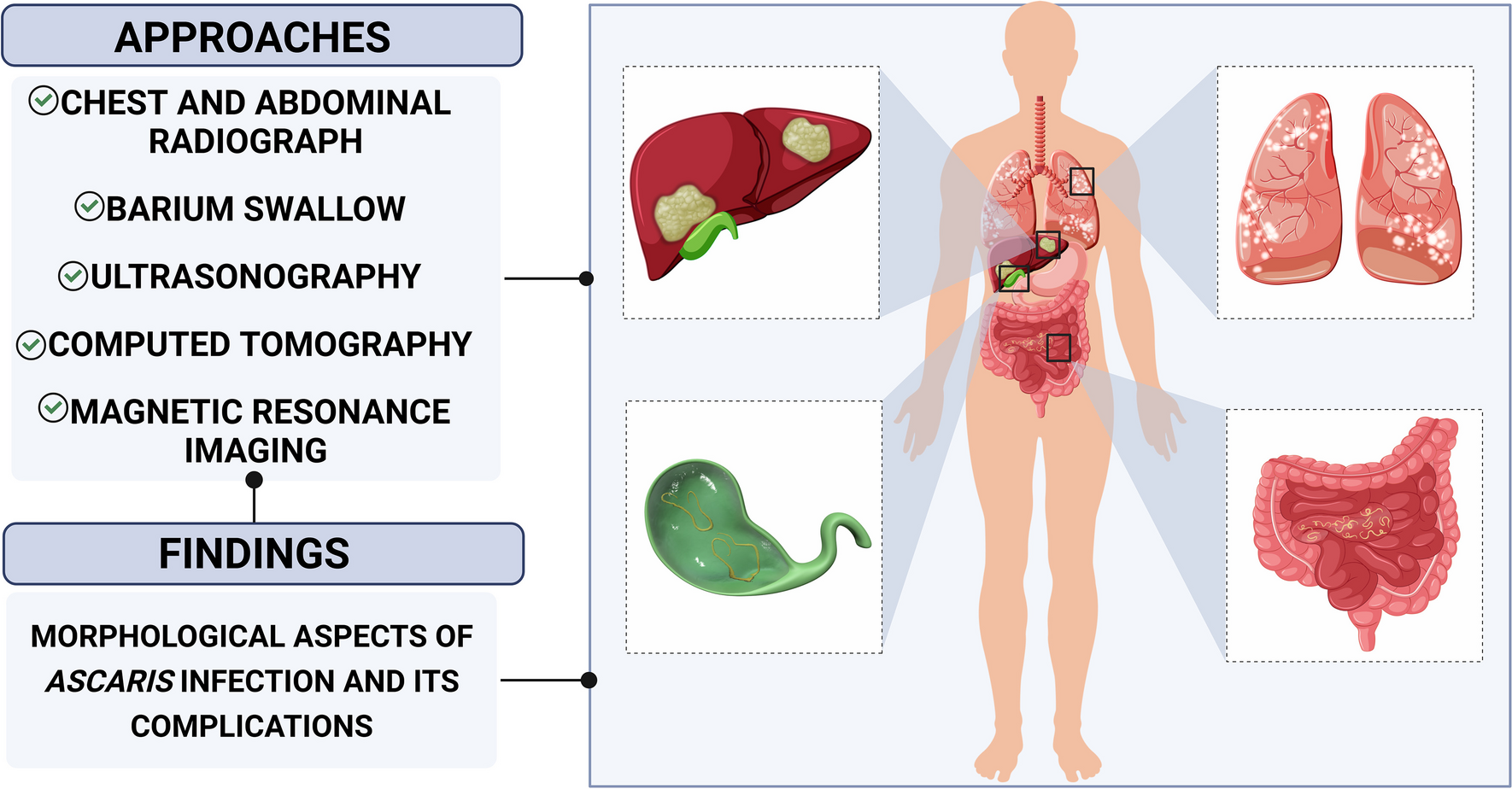 Multimodality imaging of pediatric ascariasis