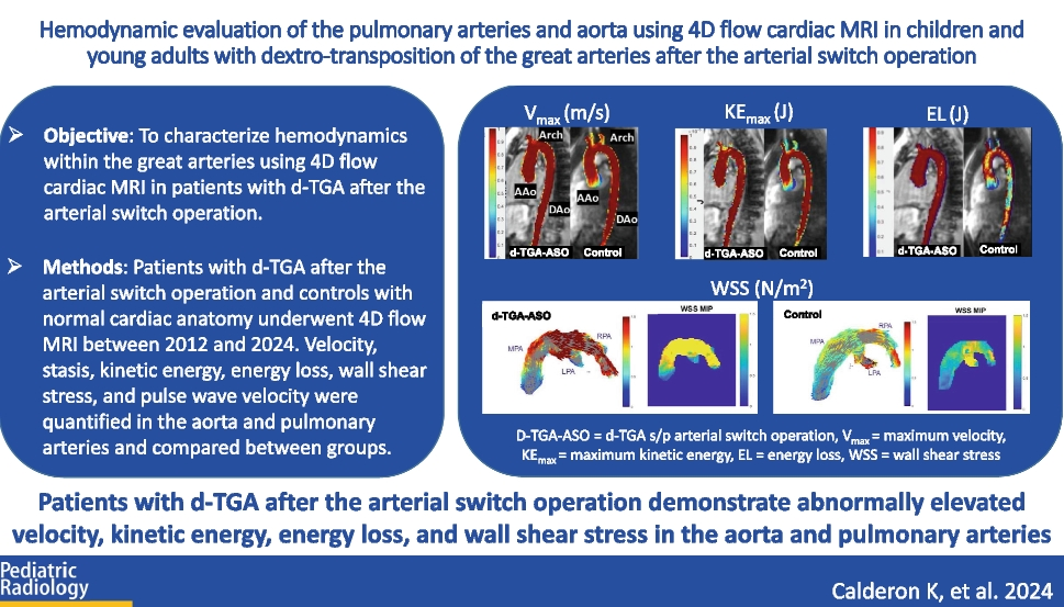 Hemodynamic evaluation of the pulmonary arteries and aorta using 4D flow cardiac MRI in children and young adults with dextro-transposition of the great arteries after the arterial switch operation