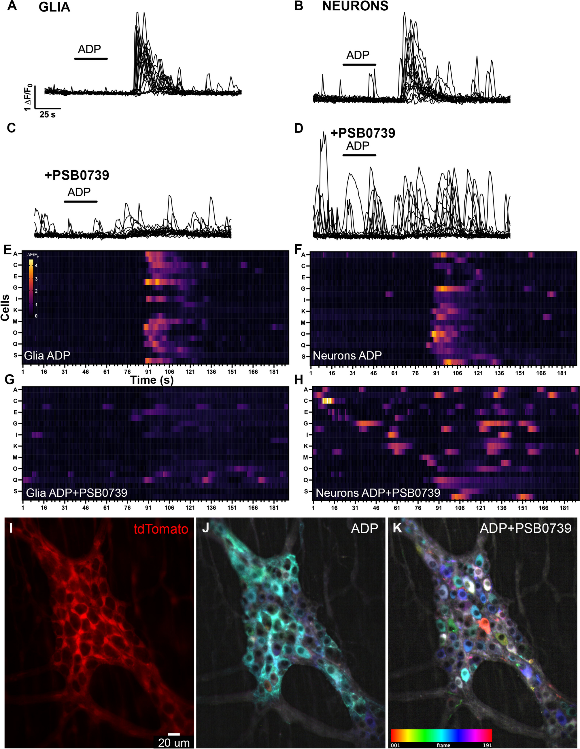 Purinergic P2Y1 and P2Y12 receptors control enteric nervous system activity through neuro-glia-macrophage crosstalk