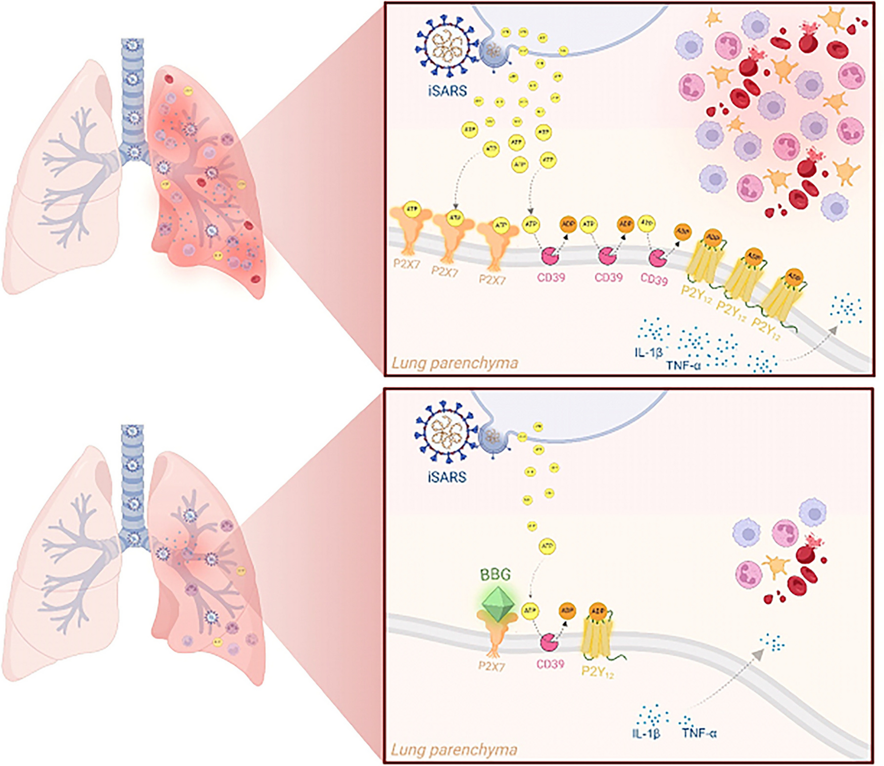 The role of the P2X7 receptor in inactivated SARS-CoV-2-induced lung injury