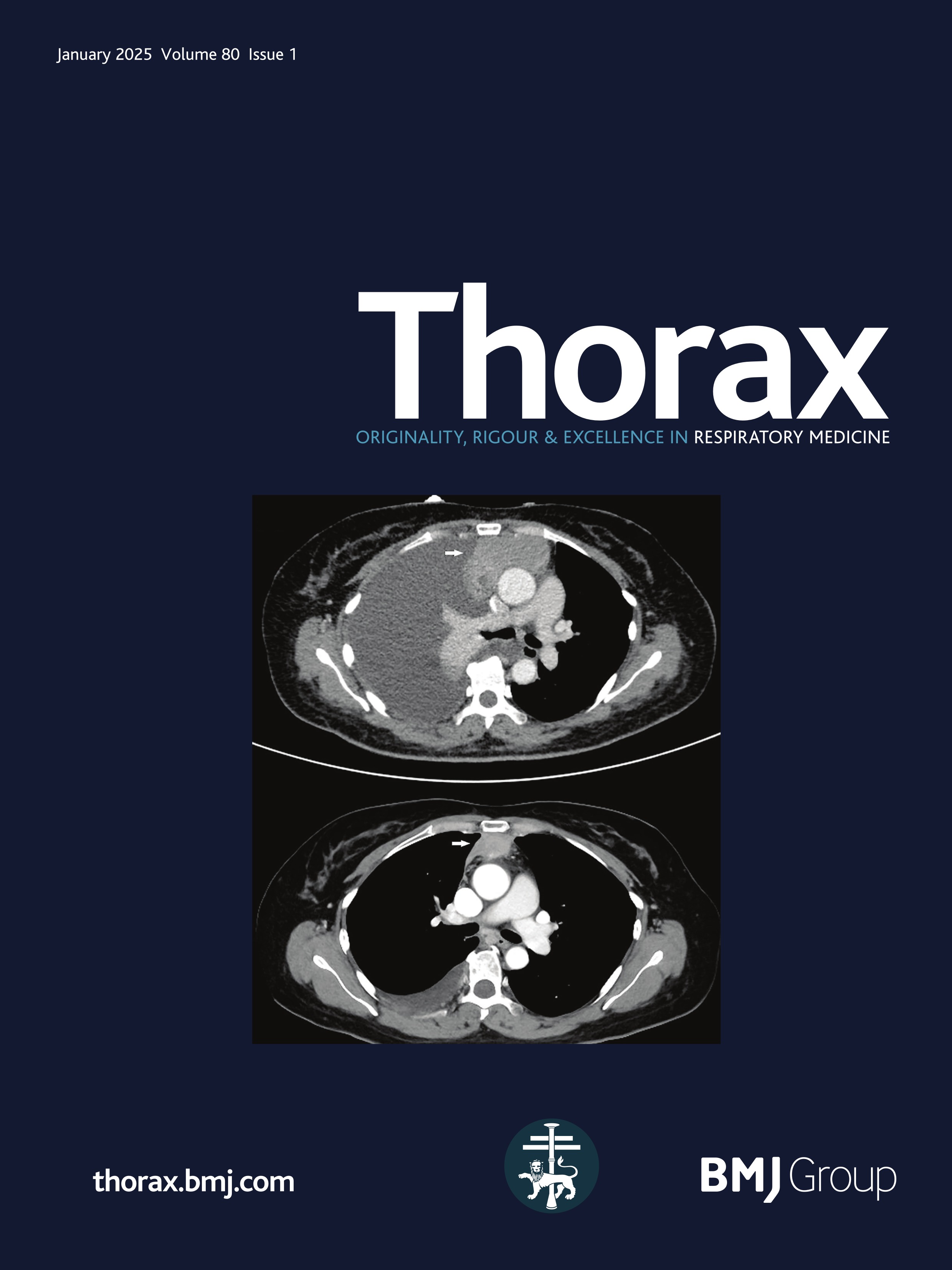 Comparative estimate of glucose-lowering therapies on risk of incident pneumonia and severe sepsis: an analysis of real-world cohort data