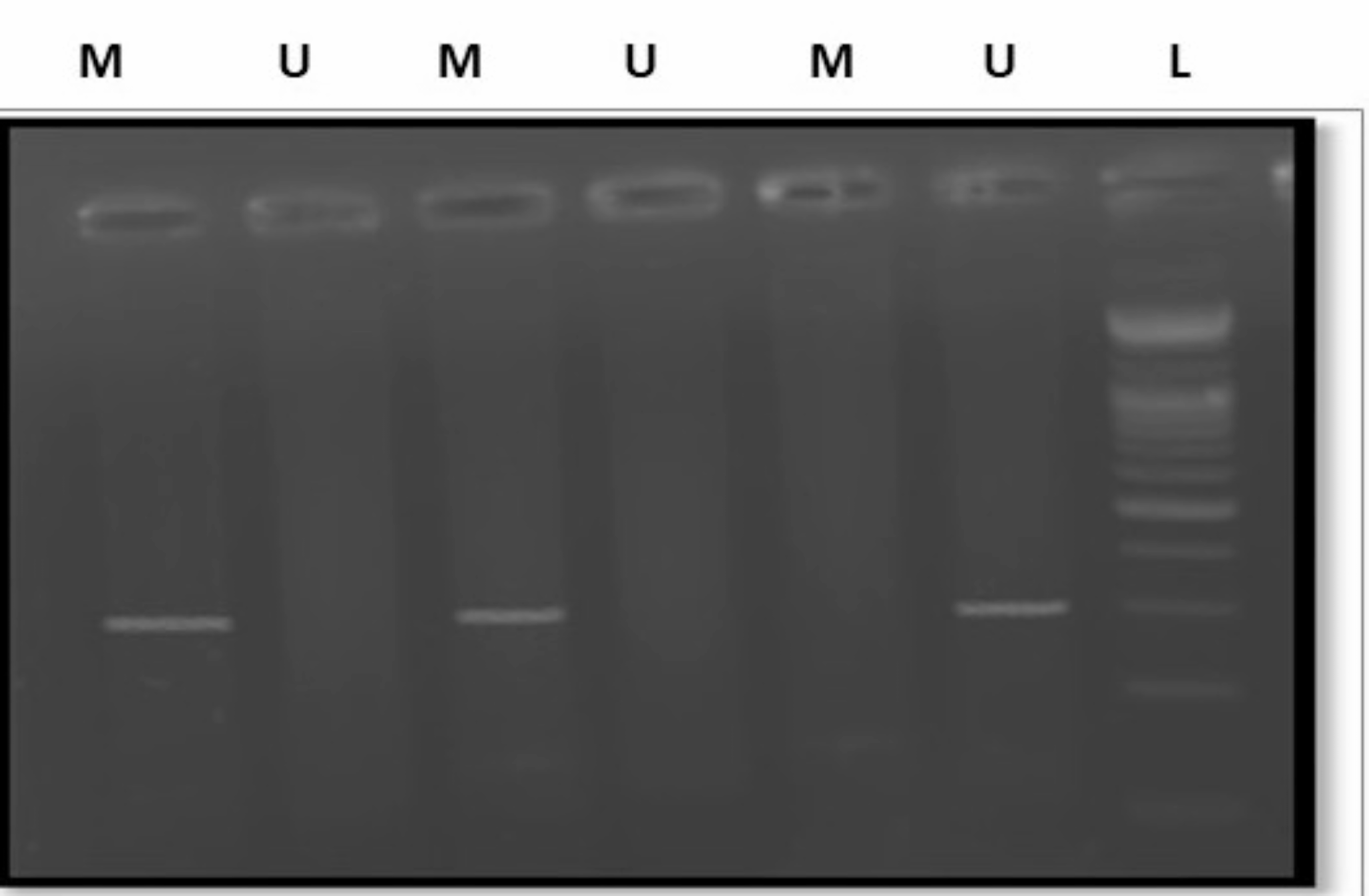 Downregulation of Hedgehog Interacting Protein (HHIP) in Gastric Cancer: Implications for Tumorigenesis