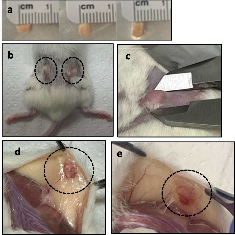 Evaluation of the In Vivo Efficacy of the JAK Inhibitor AZD1480 in Uterine Leiomyomas Using a Patient-derived Xenograft Murine Model