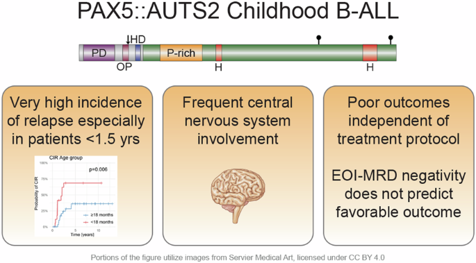 PAX5::AUTS2 childhood B-ALL: a relapse-prone genetic subtype with frequent central nervous system involvement and a poor outcome