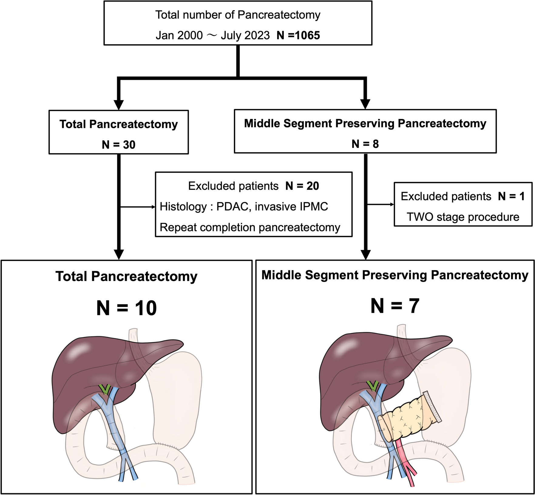 Middle segment preserving pancreatectomy versus total pancreatectomy: a comparative analysis of short- and long-term outcomes
