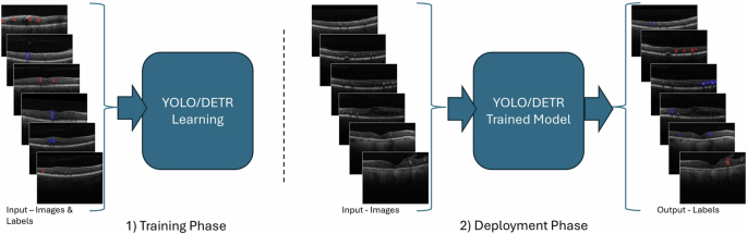 Deep learning model for automatic detection of different types of microaneurysms in diabetic retinopathy