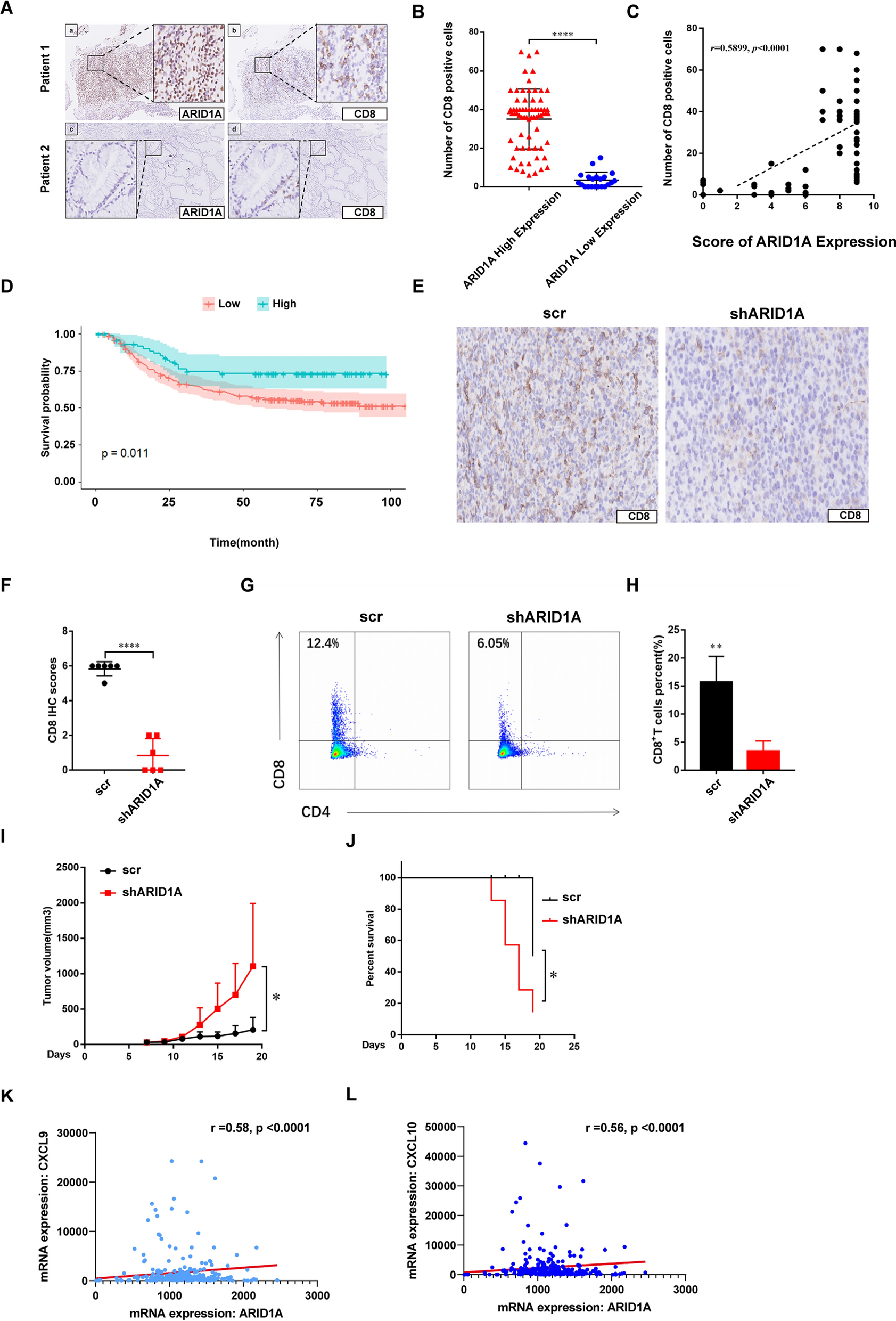 Impaired ARID1A expression attenuated the immune response in gastric cancer via histone acetylation