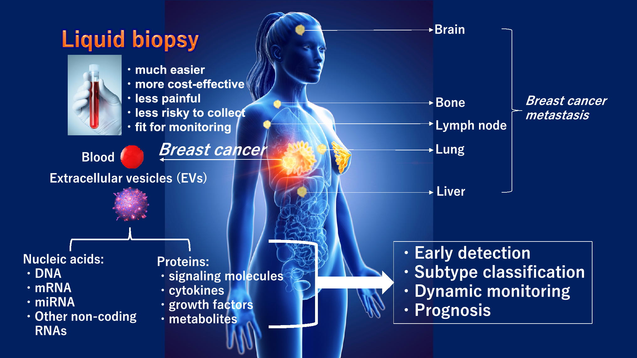 Prospects for liquid biopsy using microRNA and extracellular vesicles in breast cancer