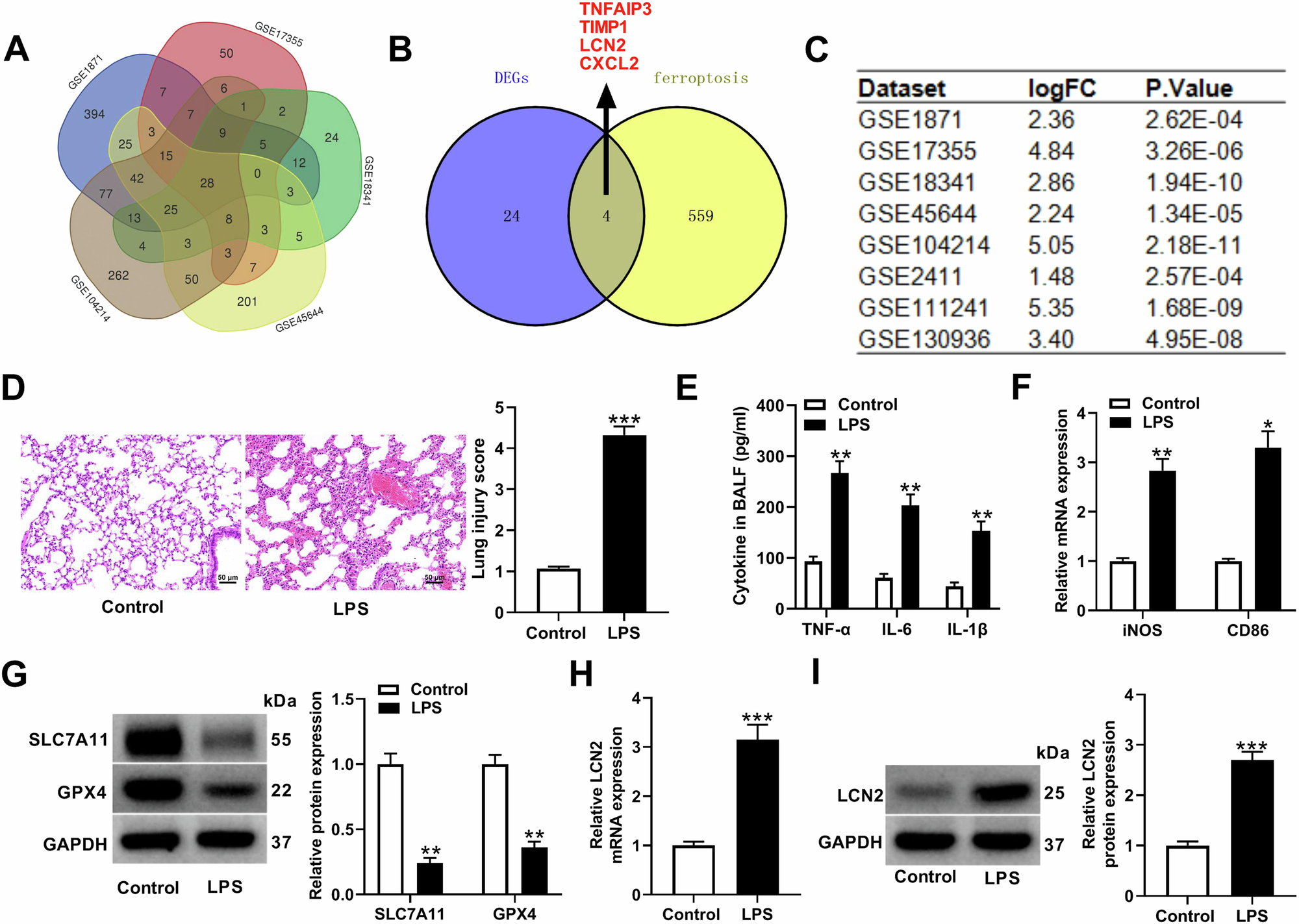 IRF7 Activates LCN2 Transcription to Enhance LPS-Induced Acute Lung Injury by Inducing Macrophage Ferroptosis and M1 Polarization