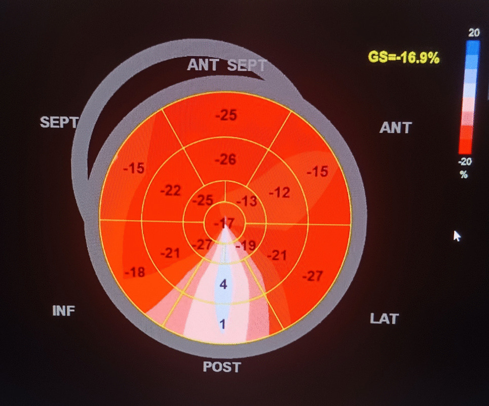 Multi-Modality Imaging in Cardio-Rheumatology