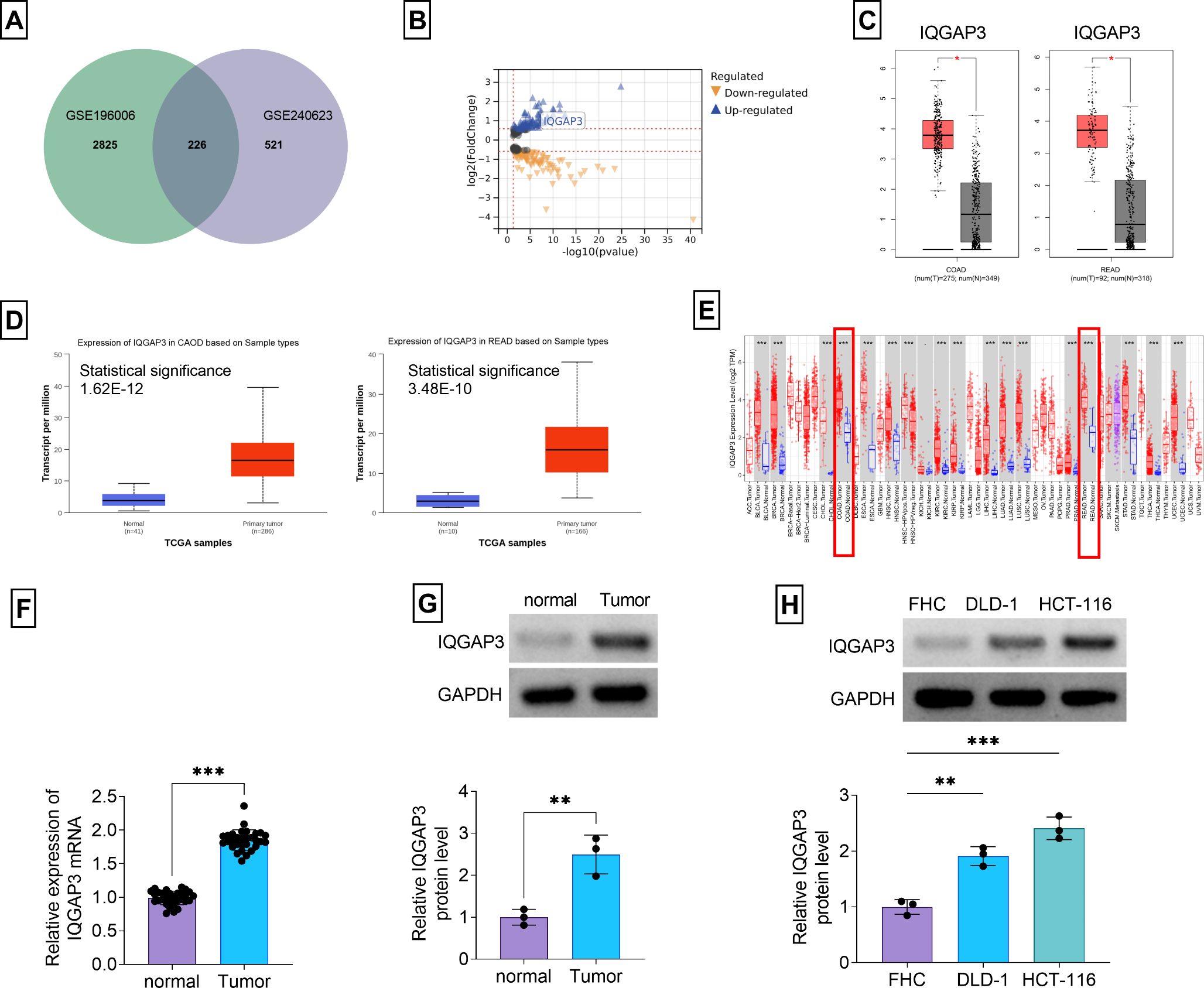 PRKN-mediated the ubiquitination of IQGAP3 regulates cell growth, metastasis and ferroptosis in early-onset colorectal cancer