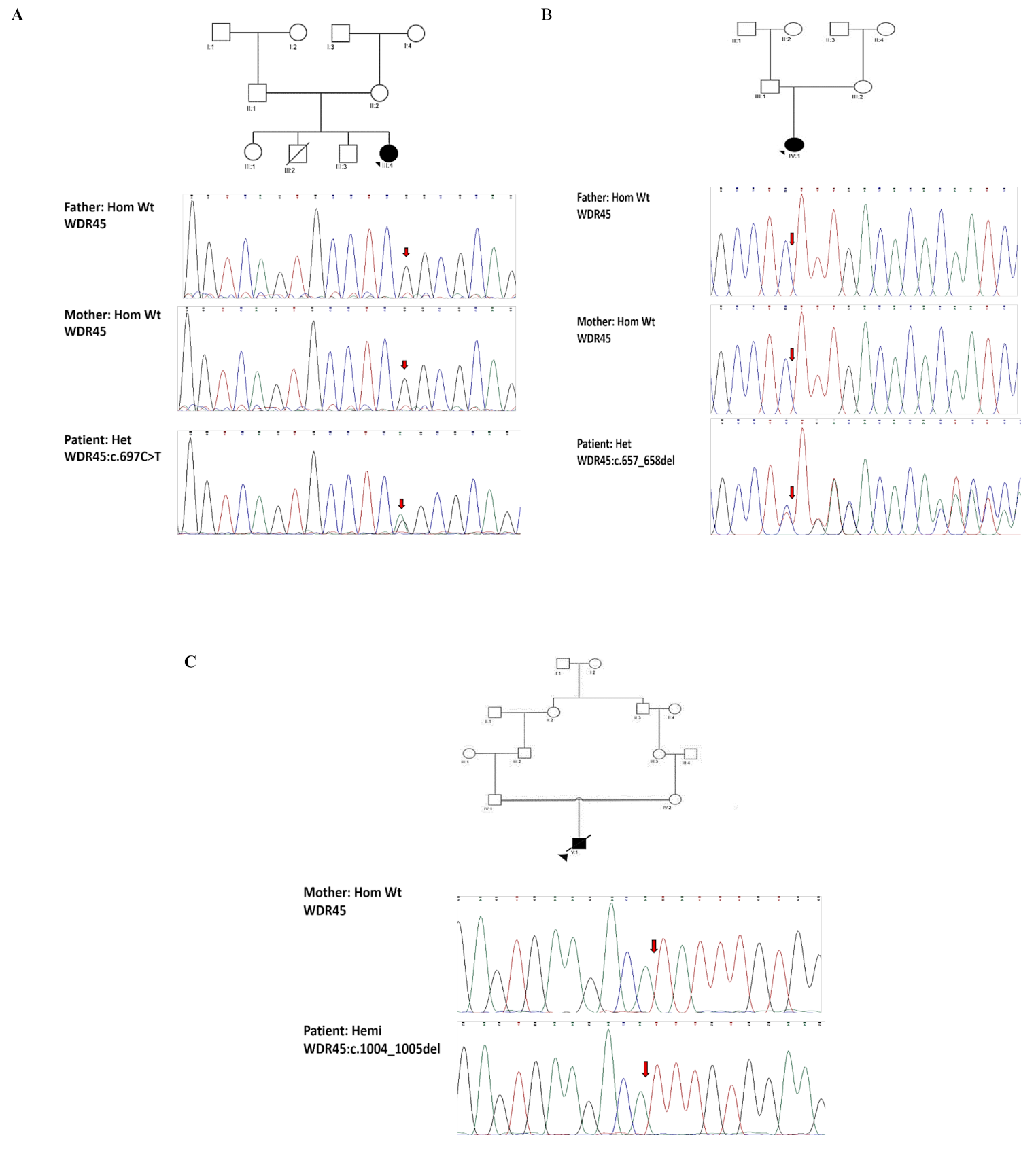 Neurodegeneration with brain iron accumulation 5: report of three cases