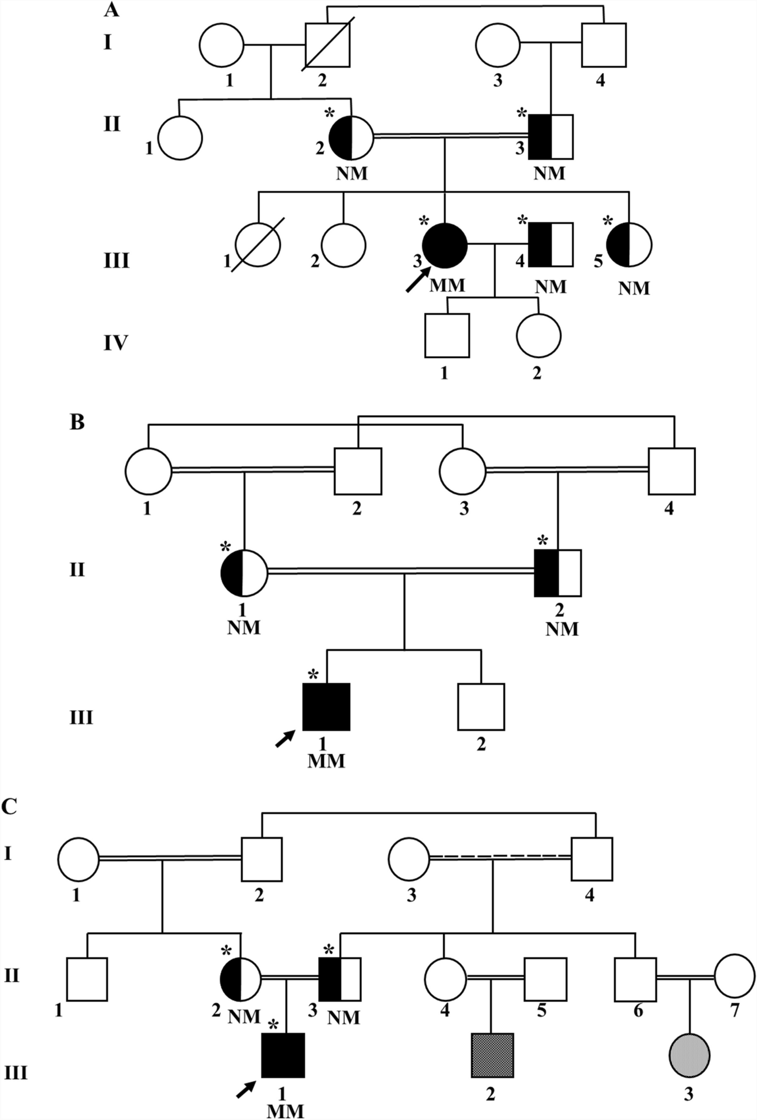 Three Iranian patients with rare subtypes of hereditary spastic paraplegia (HSP): SPG76, SPG56, and SPG69