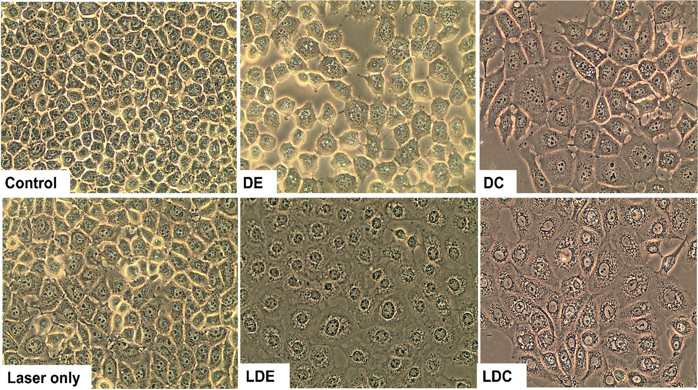 Anti-proliferative and photodynamic activities of Senna didymobotrya (Fresen.) leaf alkaloid-rich extracts against breast cancer cells