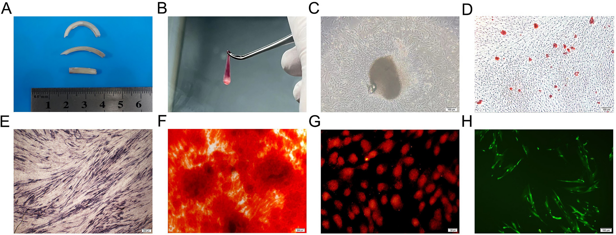 The potential role of SCF combined with DPCs in facial nerve repair