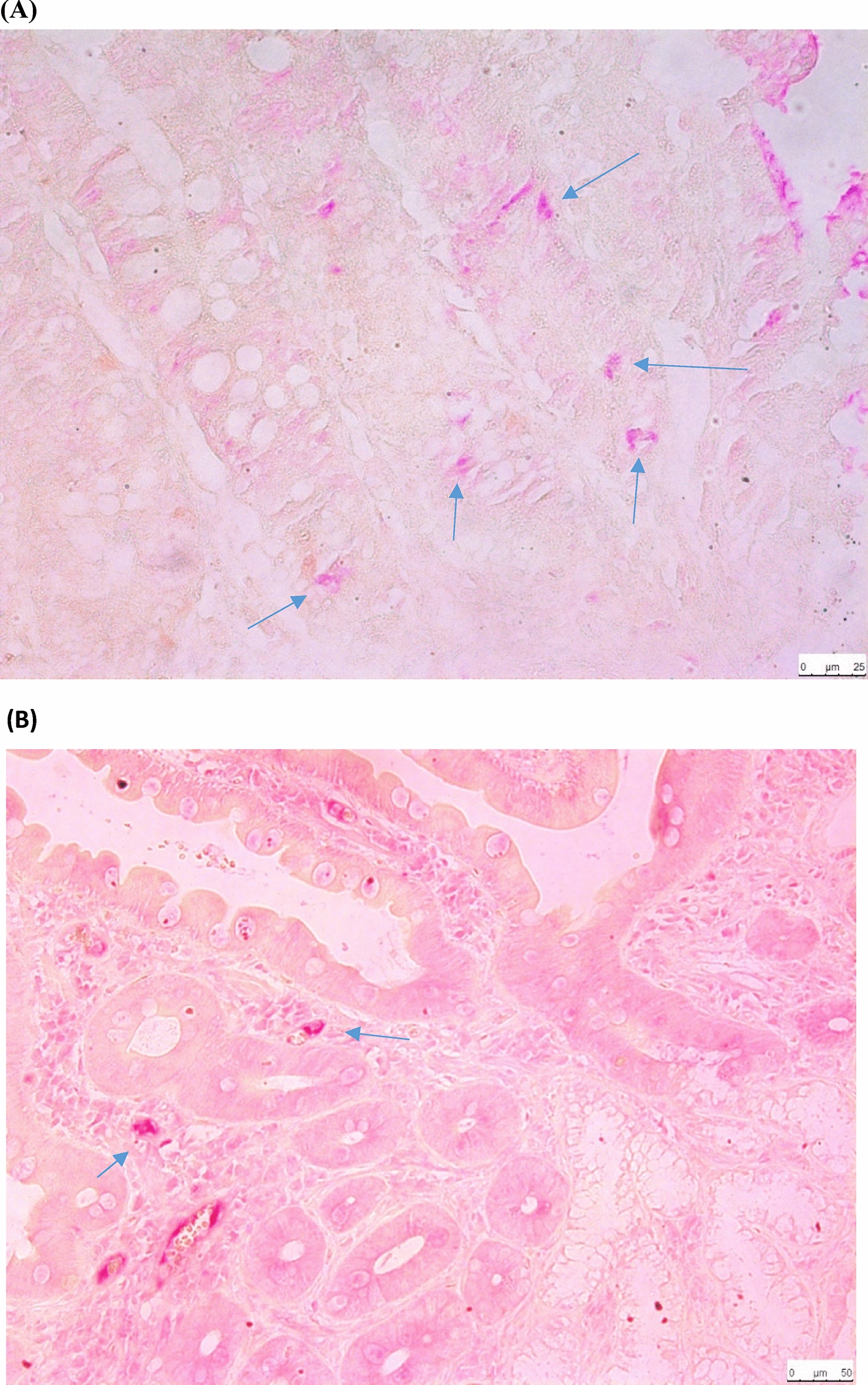 Immunohistochemical evaluation of LGR5, CD71, CD138 and CXCR3 markers in the small bowel mucosa of participants with celiac disease and persons with normal bowel mucosa
