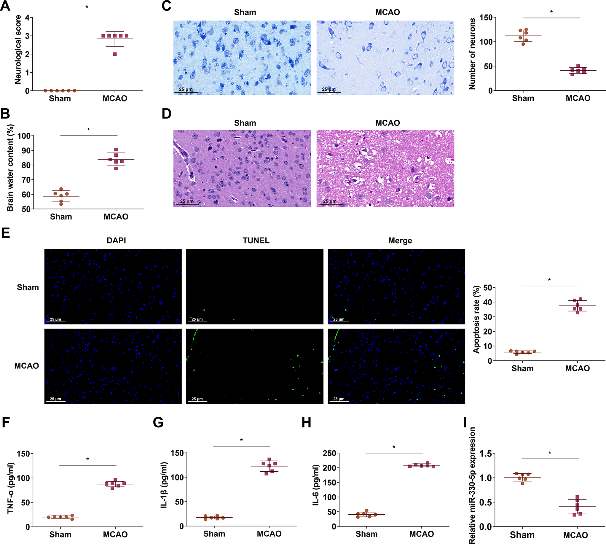 mir-330-5p from mesenchymal stem cell-derived exosomes targets SETD7 to reduce inflammation in rats with cerebral ischemia-reperfusion injury