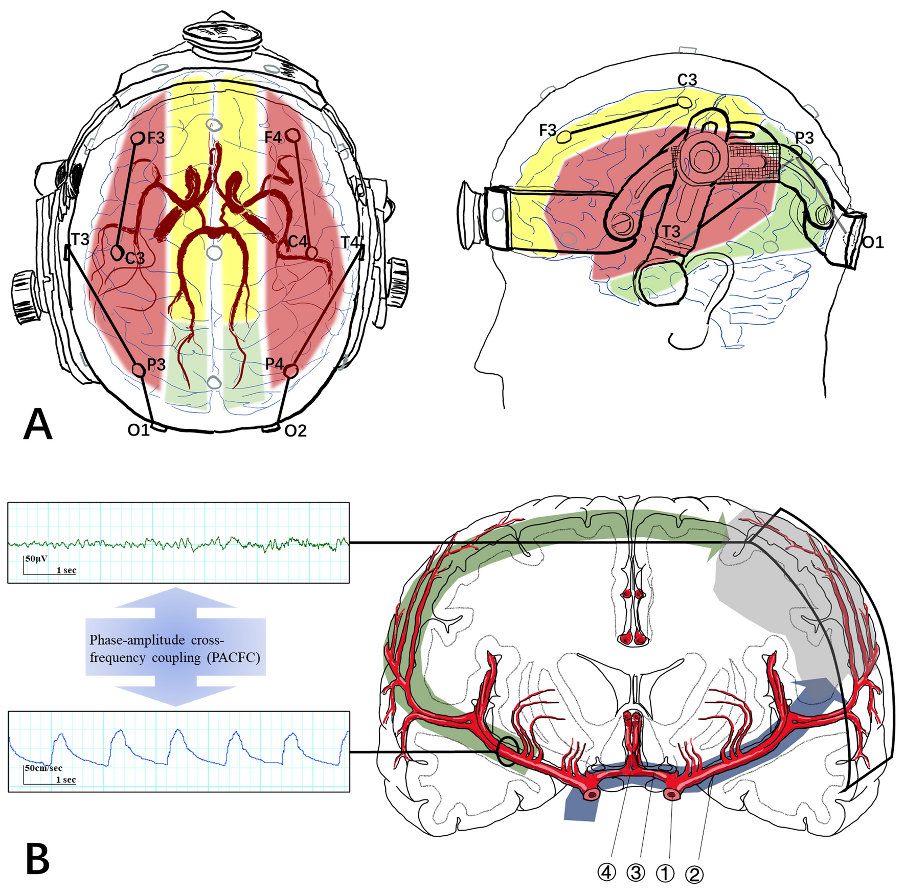 Contralateral Neurovascular Coupling in Patients with Ischemic Stroke After Endovascular Thrombectomy