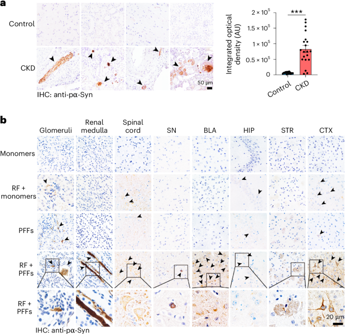 α-Synuclein deposition in the kidney may contribute to Parkinson’s disease