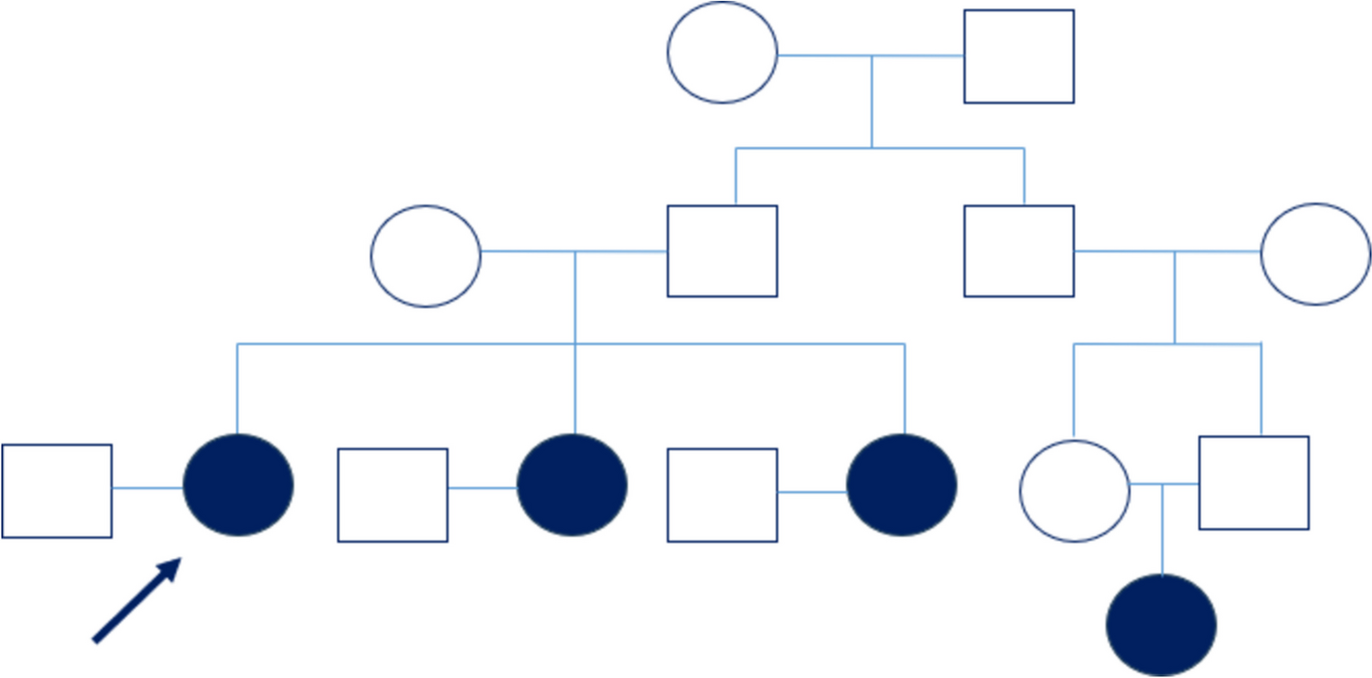 Familial Papillary Thyroid Carcinoma—4 Members from a Single Family
