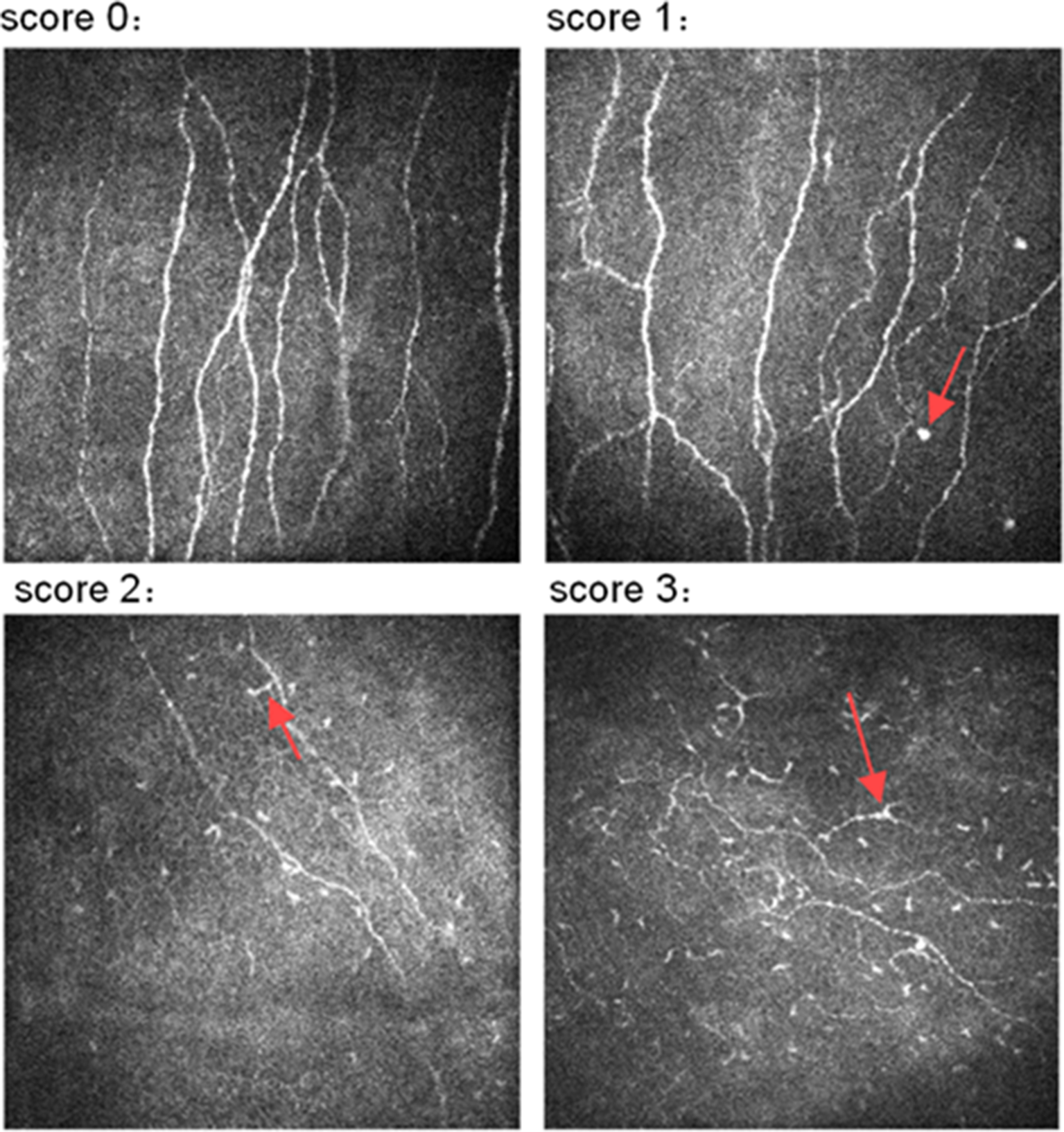 Corneal nerve abnormalities in early-stage diabetic retinopathy evaluated by corneal confocal microscopy