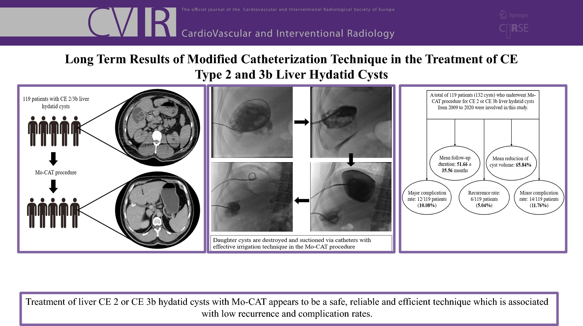 Long-Term Results of Modified Catheterization Technique in the Treatment of CE Type 2 and 3b Liver Hydatid Cysts