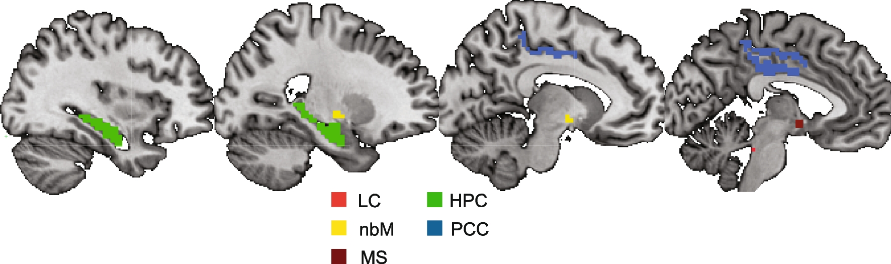 Attention-dependent coupling with forebrain and brainstem neuromodulatory nuclei differs across the lifespan