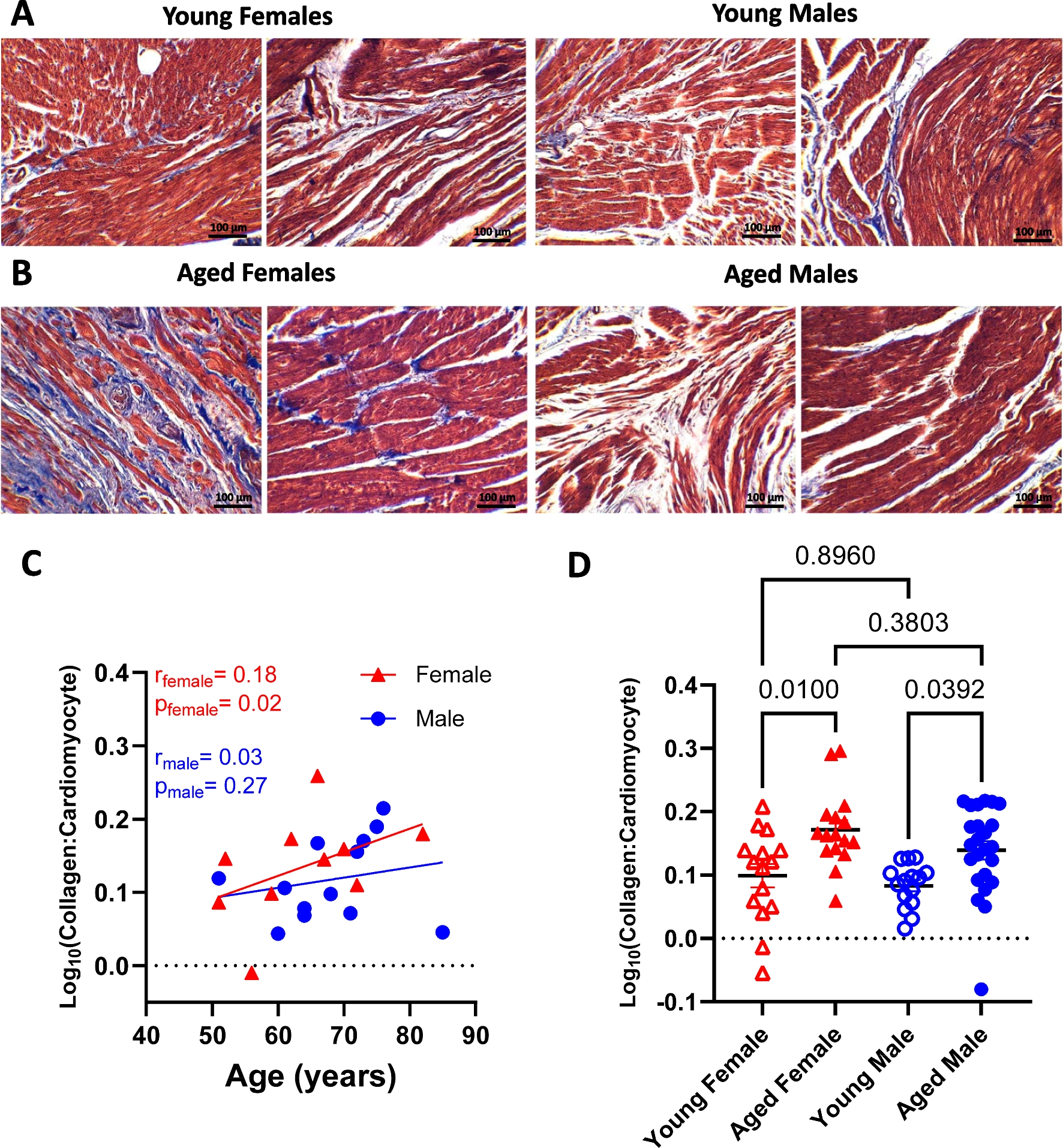 Sex-specific molecular drivers of cardiac fibrosis in aging hearts
