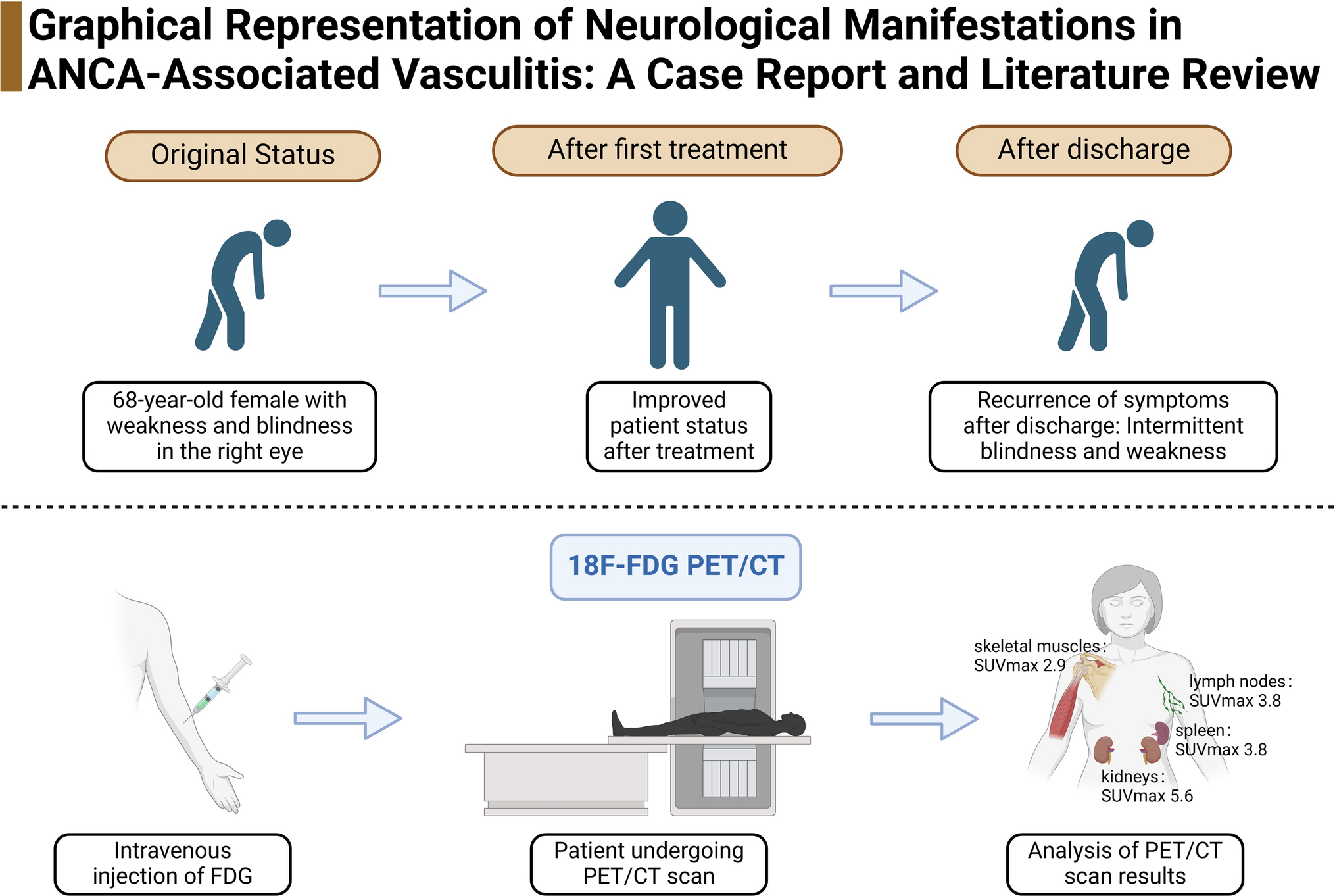 Role of 18F-FDG PET/CT in assessing systemic involvement in ANCA-associated vasculitis
