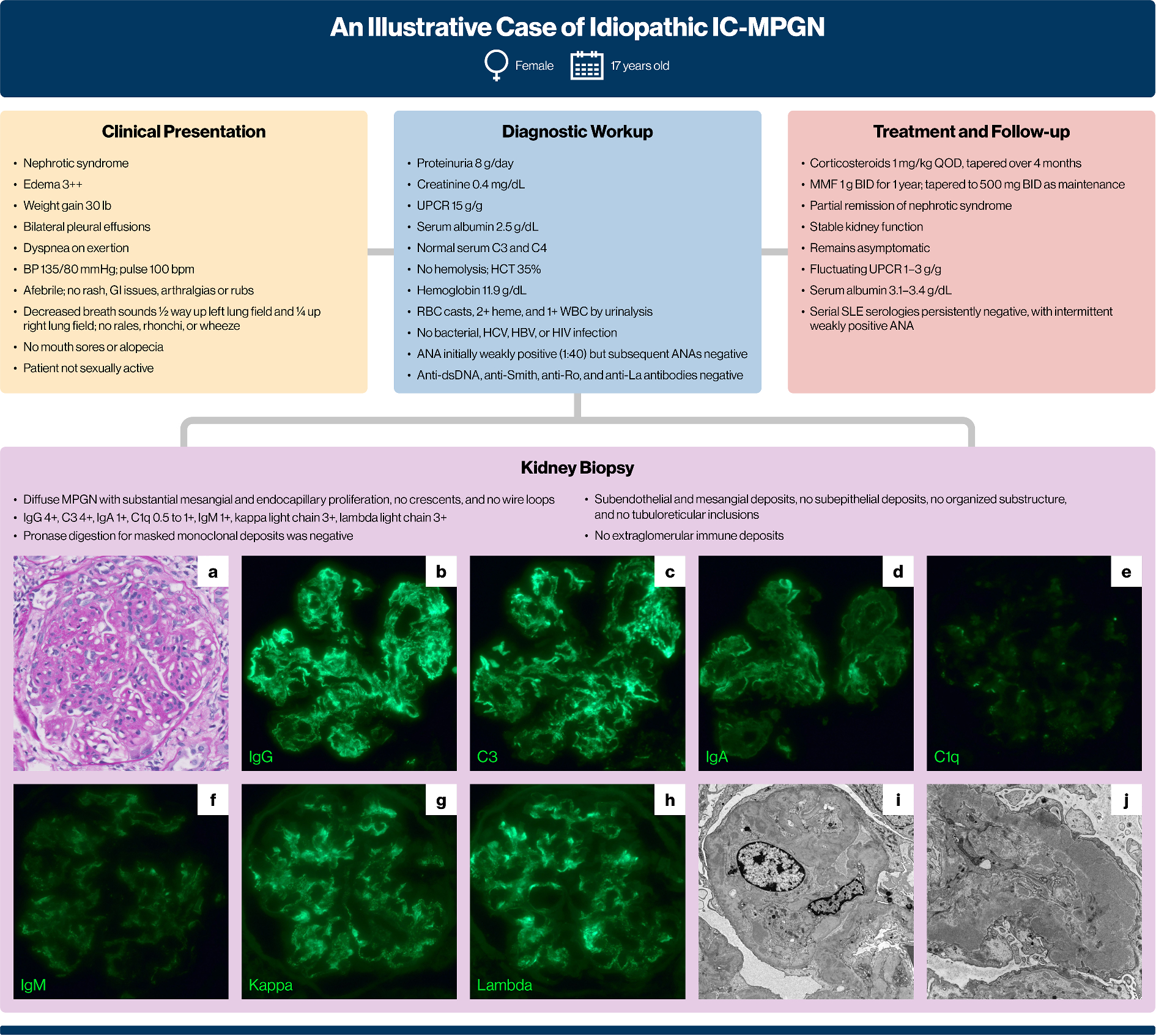 Expert Discussion on Immune Complex-Mediated Membranoproliferative Glomerulonephritis: Challenges and Considerations