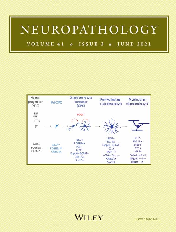 Primary central nervous system lymphomas with massive intratumoral hemorrhage: Clinical, radiological, pathological, and molecular features of six cases