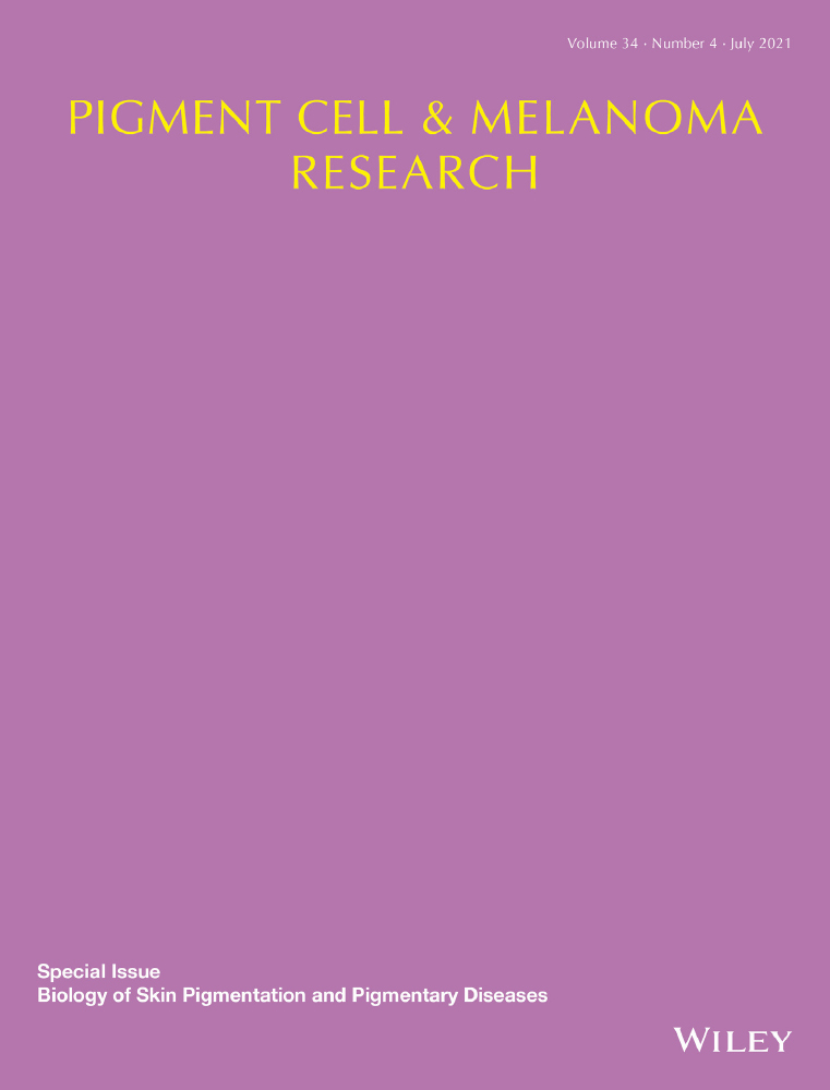 The Role of Ferroptosis in Melanoma