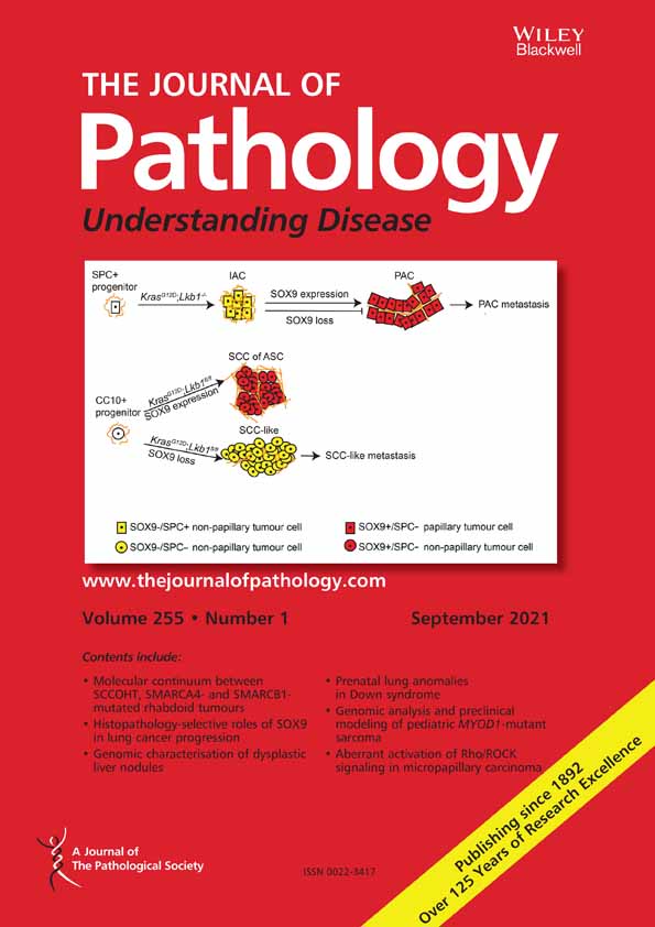Reciprocal YAP1 loss and INSM1 expression in neuroendocrine prostate cancer