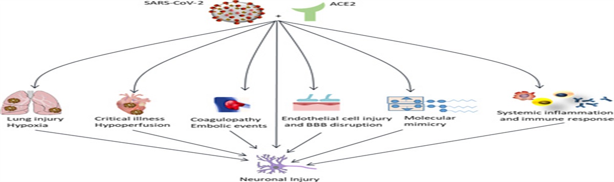 Treatment Options for COVID-19–Related Guillain-Barré Syndrome: A Systematic Review of Literature