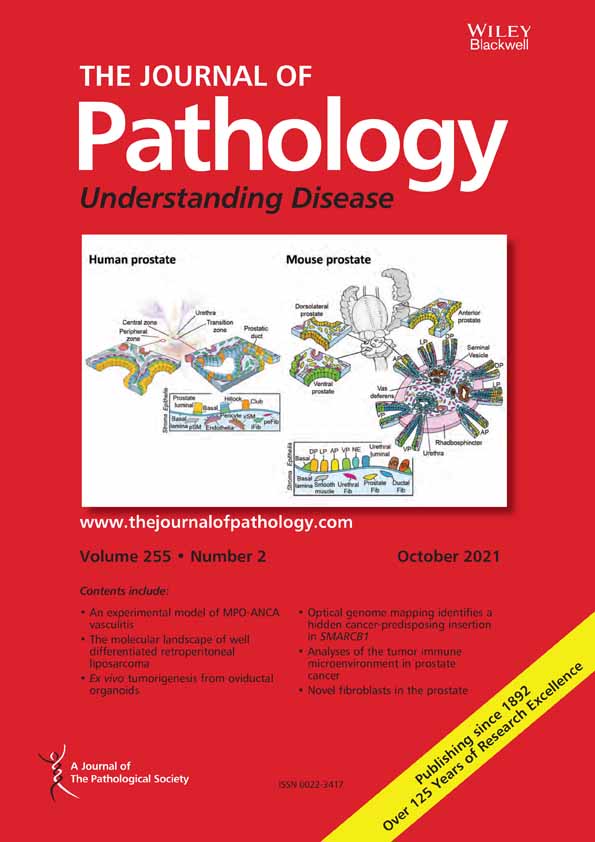 Molecular genetic evidence supporting diverse histogenic origins of germ cell tumors